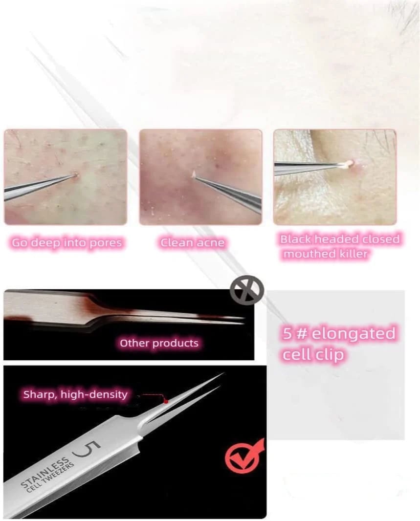 💓Last day discount💥Medical grade blackhead cell clip tool set