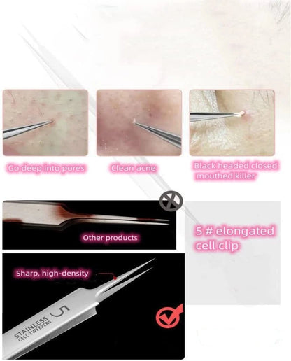 💓Last day discount💥Medical grade blackhead cell clip tool set